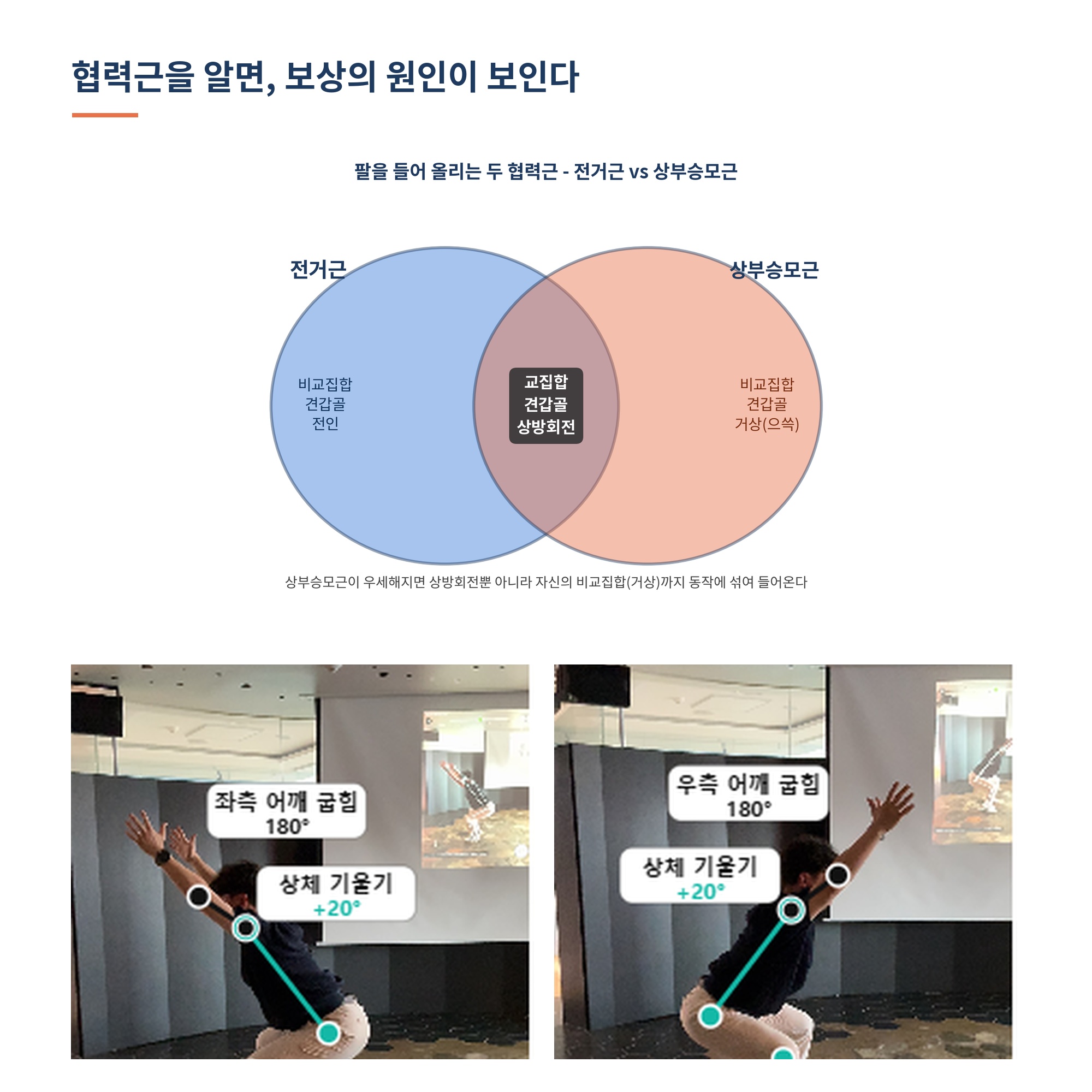 협력근을 알면, 보상의 원인이 보인다