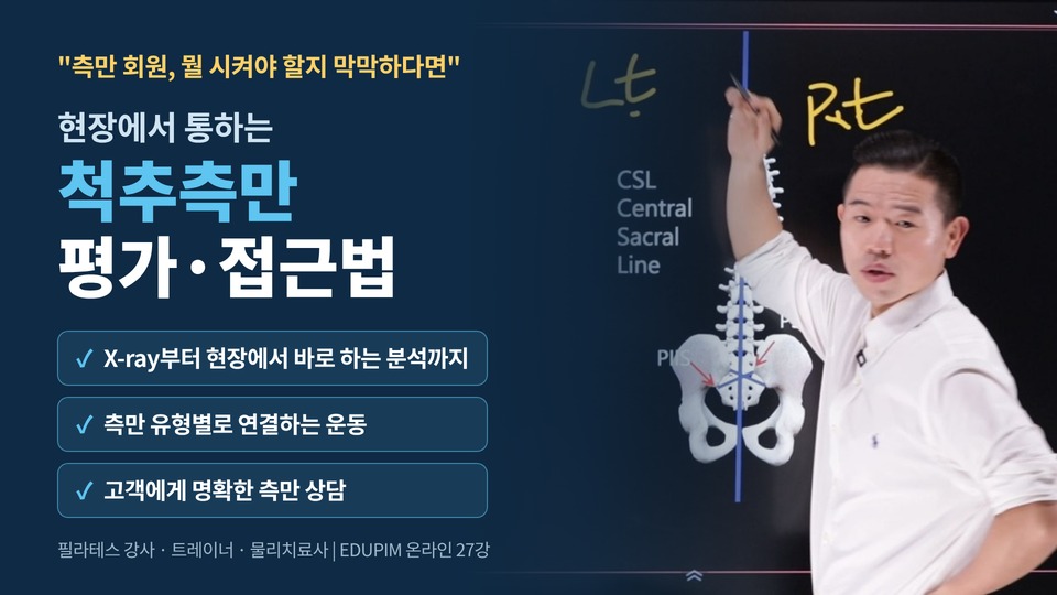 현장에서 통하는 척추측만 평가·접근법